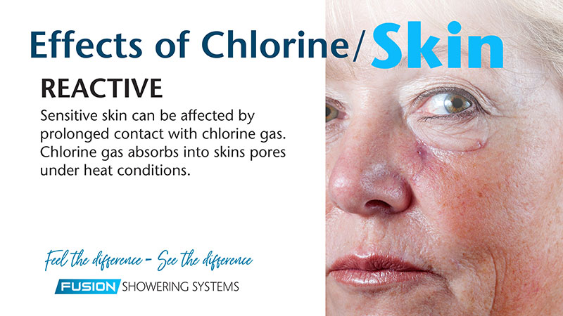 Effects of chlorine on skin - Reactive
